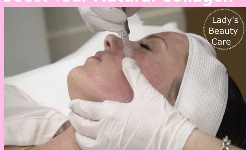 Skin Needling