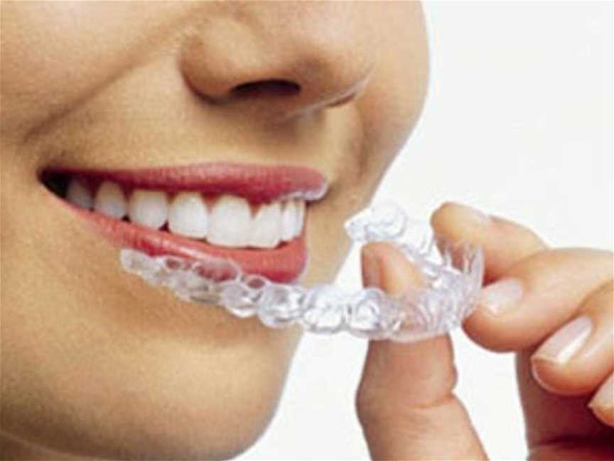 Invisalign